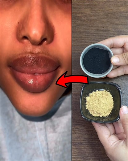 How to whiten teeth naturally - Natural teeth whitening in 3 minutes #healthtips #teethwhitening #teethcare #oralcare #naturalremedy #naturalrecipes | Simple Home Remedies