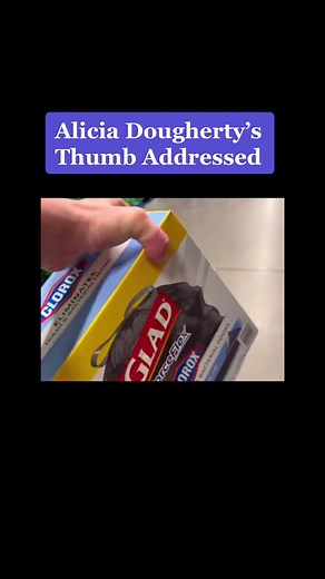 Understanding Alicia Dougherty's Clubbed Thumbs: Brachydactyly Diagnosis