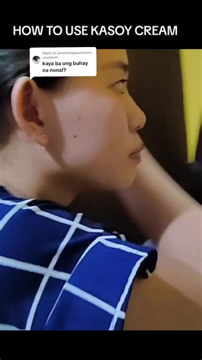 Kasoy Cream Review: Effective Mole Removal Process