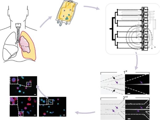 Catching Cancer Clusters Without Breaking Them | Newswise