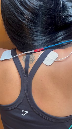 E-Stim For Stronger & Faster Recovery ⚡️ Those muscle contractions you feel/ see during e-stim? They're activating your muscles to reduce pain, relax tight areas, and boost strength - all while you relax. Ask us if e-stim can help your pain or recovery! 💪⚡️ | The Therapy House Chiropractic & Wellness
