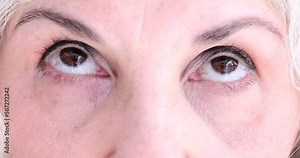 Brown eyes of elderly woman makes relaxing exercise for eyes. Hyperopia myopia astigmatism and glaucoma in retirement
