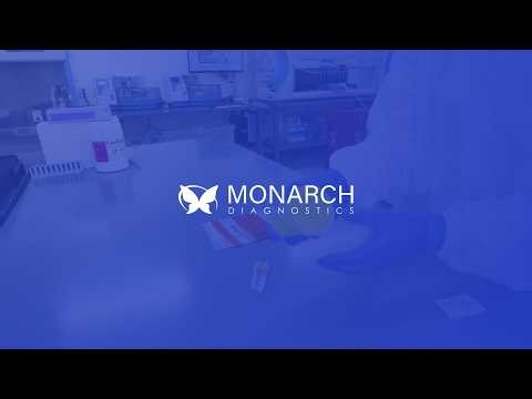 Urine Specimen Collection & Vial Transfer Instructions | Monarch Diagnostics