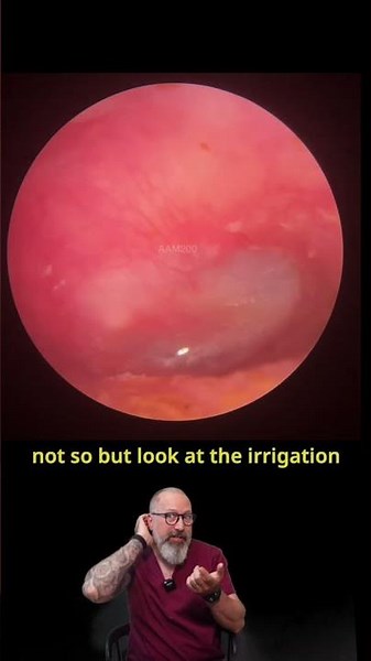 Light Reflex Hiding Behind the Compacted Wax 👂 - MEP200