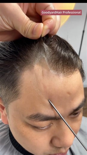 1.5M views · 5.3K reactions | Don't let hair loss define you. Our...