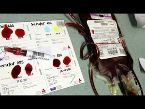 14.11.1901: Die Blutgruppen werden entdeckt