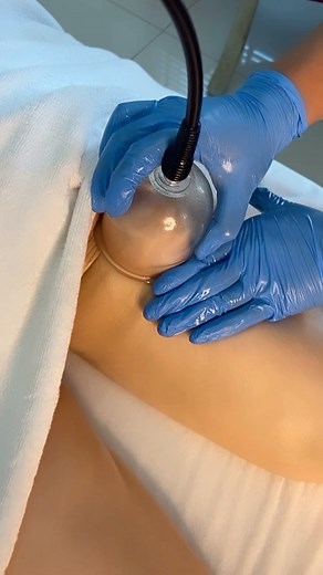 1.8K views · 4 comments | Body suction combined with a massage is an...