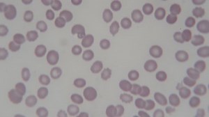 menschliche Blutkörperchen mit Mikroskop: Stockvideos & Filmmaterial (100 % lizenzfrei) 1006785946 | Shutterstock