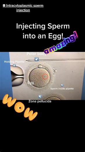 Intracytoplasmic Sperm Injection (ICSI) is a method to fertilize eggs. #LearnOnTikTok #TikTokPartner #ttc #ivf #infertility