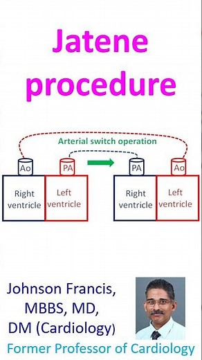 Jatene procedure