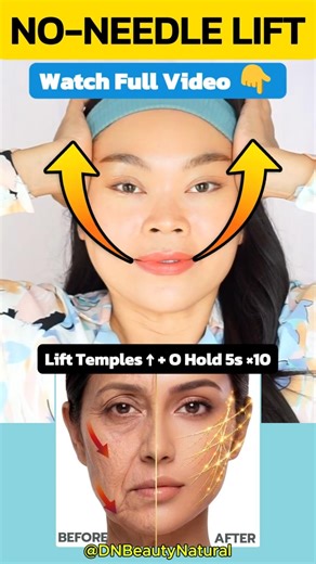 LIFT YOUR FACE IN 5 MIN 🔥 (NO NEEDLES)