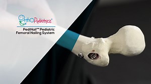 OrthoPediatrics PediNail - Pediatric Femoral Nailing System