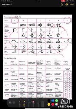 EXPANDED NEW BALLARD SCORE | NEETPG | INICET | HIGH YIELD | paediatric | by ABHIROOP BOSE