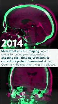 How Elekta revolutionized radiotherapy with in-room imaging #shorts