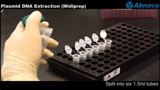 Plasmid DNA Extraction (Midiprep)