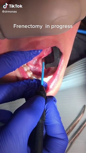 Stone Surgical Arts on TikTok
