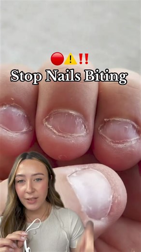 How to stop biting your nails ‼️⚠️🔴 Do you bite your nails? 👀 shades: 💪 Build Powder 🌷 Pretty Petal - #nailart #naillooks #nails #nailgram #nailinspo #nailsathome #nailtrends #naildesign #nailartist #diynails #nailhack #easynails #nailvideo #nailtutorial #dippowder #dippowderdesign #dipnails #dippowdernails #trendynails #nailsoftheday #nailtech #nailtutorials #nailboo #nailsofinstagram #nailsalon #DIYnails #dippowdermanicure #dipkit #gelpolish #summernails | Nailboo