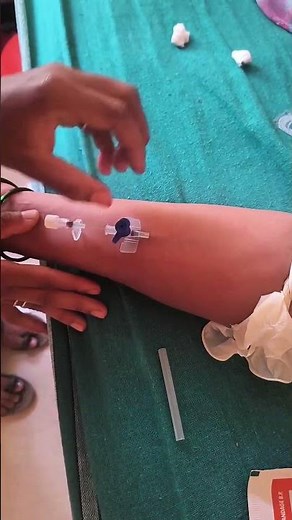 How to Insert an IV Cannula | Step-by-Step Guide for Beginners #drupdate #cannulation