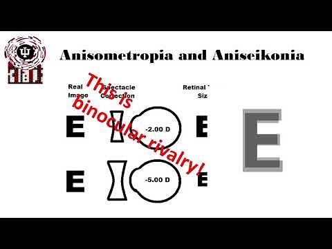 Anisometropia Definitions