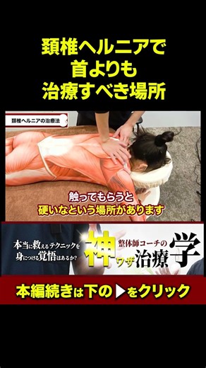 [Must see] People who treat their neck for cervical hernia are outdated