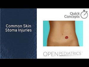 Common Skin Stoma Injuries by L. Abecassis | OPENPediatrics