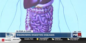 19 for a Cure: Diagnosing digestive disease