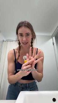 Calluses on the hand as a circus performer