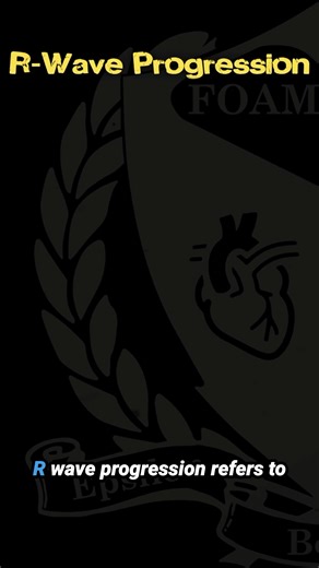 75K views · 715 reactions | 12-Lead R-Wave Progression | FOAMfrat | Facebook