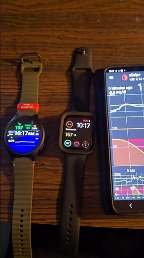 My Diabetic Setup w/ Xdrip+, Direct to Apple Watch and Galaxy Watch 7 on Dexcom G7