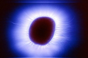 Visual halos around lights: what diseases to think of?