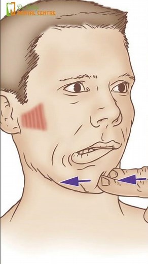Understanding and Treating Jaw Pain: Is it Radiating Pain from the Lateral Pterygoid Muscle?