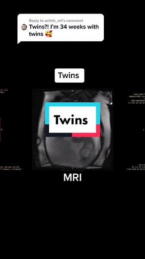Reply to @ashhh_mf #fyp#fy#foryoupage#foryou#babymama#pregnant#mom#baby#fetus#life#love#midwifery#midwifestudent#viral#mothers#mommy#🤰