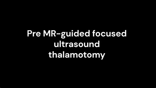 Patient movements pre and post MR-FUS