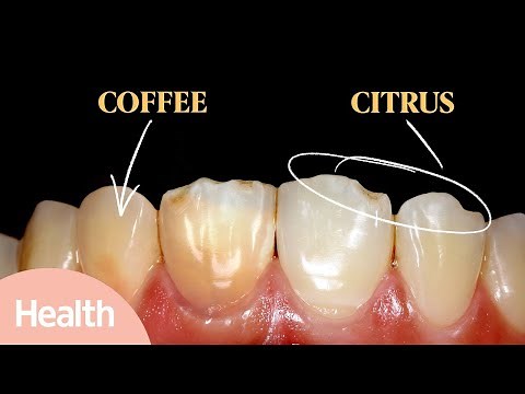 What Causes Yellow Teeth? | How to Whiten Your Teeth for a Brighter Smile | Deep Dives | Health