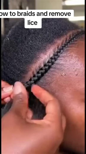 How to Braid Hair and Remove Lice Effectively