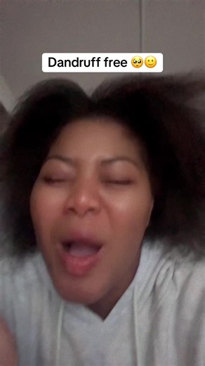 Affordable Solution for Dandruff Relief