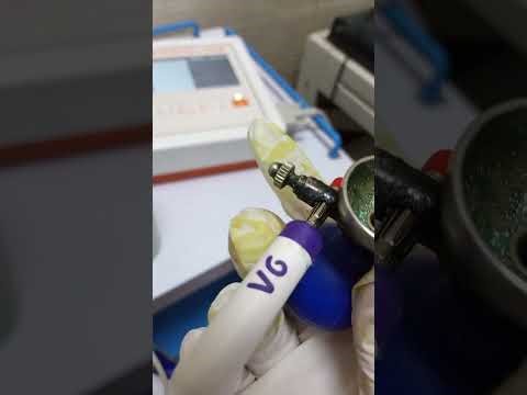 Electrocardiogram || ECG Machine | How to use ecg | ECG leads #electrocardiograma #machine #ecg