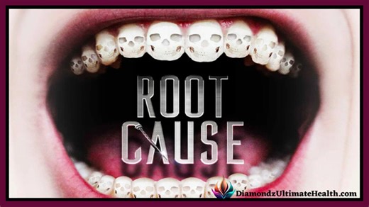 🎬 🦷 Documentary: 'Root Cause' ✩ Chronic and Dangerous Health Issues Caused By Root Canal Procedures
