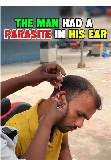 Ear & Scalp ASMR Deep Cleaning for Ultimate Relaxation