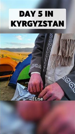 HIS SKIN IS FALLING OFF