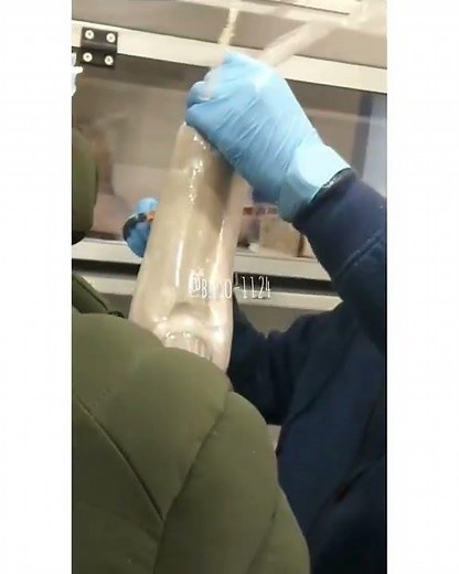 Transtibial Prosthesis with Laminated Socket