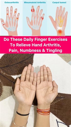 Do These Daily Finger Exercises To Relieve Hand Arthritis, Pain, Numbness & Tingling Sarv Samridhi Yoga #handarthritis #arthritis #arthritisrelief #ArthritisAwareness #Numbness #tingling #TinglingRelief #fingerexercise #healing #fbreels #fbreelsvideo #viralvideochallenge #virals | Sarv Samridhi Yoga