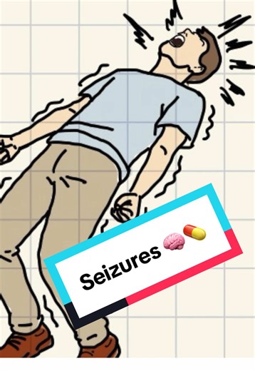 Understanding Seizures: Essential Information for Pharmacists