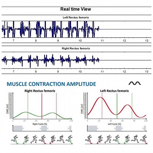 Raw vs filtered EMG signal of rectus femoris during running. ‪@TheBTSBIOENGINEERING‬