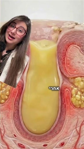 נקבוביות זה המבנה האנטומי של העור.