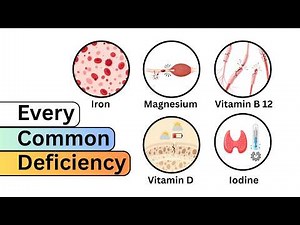 Every Common Deficiency Explained