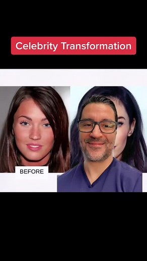 Transformations Through Cosmetic Enhancements: Megan Fox Before and After