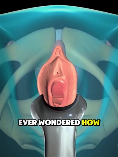 Hysterectomy Surgery: How the Uterus Is Removed & Why It’s Done #hysterectomy #womenhealth #gynesurgery #uterusremoval #medicalanimation