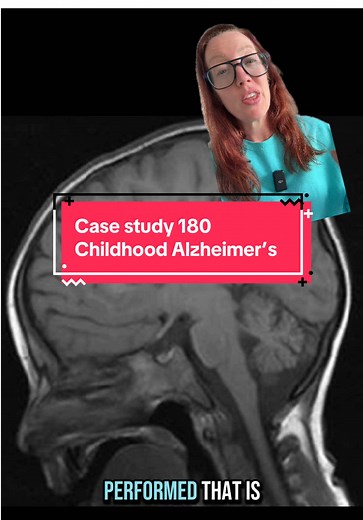 Case Study 180: Understanding Childhood Alzheimer’s