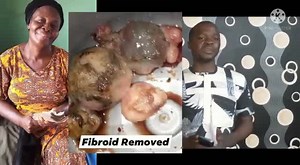 17 reactions | A 50 years old woman from IMO state saved from a dangerous fibroid that wanted to kill her, Remain blessed as you keep supporting us acct 2033270283 first bank acct name Igbos love themselves charity foundation phone +2348032795016 or whassup +918448020502 And please share. | Mathias Ezeaku - Gospel of truth | Facebook